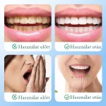 White Plus fogfehérítő por dohányzás okozta foltok csökkentésére, megszüntetésére