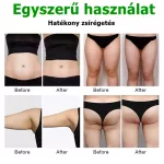 Fogyasztó, karcsúsító tapasz 12db 